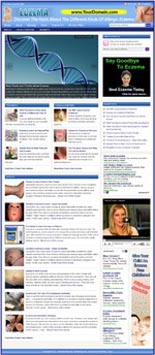 Eczema Website