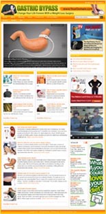 Gastric Bypass Website